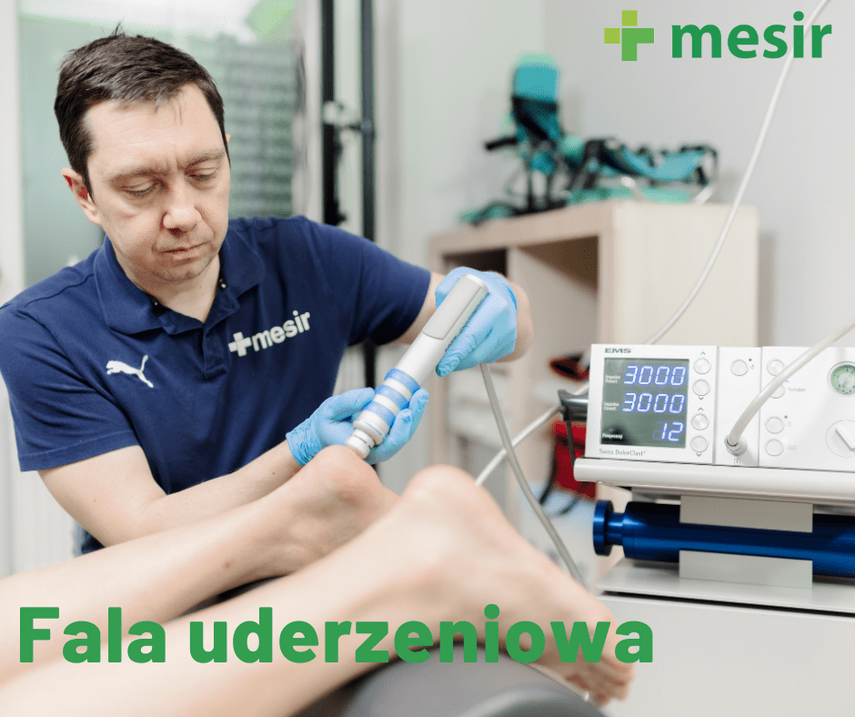 fala uderzeniowa