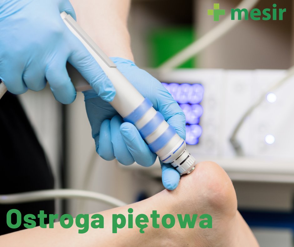 ostroga piętowa